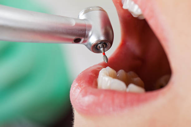 Best Weekend Emergency Dentist in Gainesboro, TN
